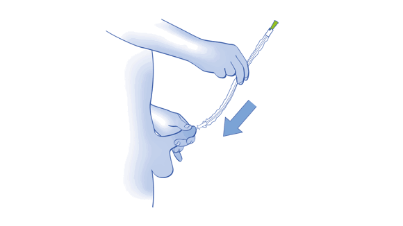 LoFric Origo Pro IFU/Quick guide illustration showing step 6 Slowly insert the catheter